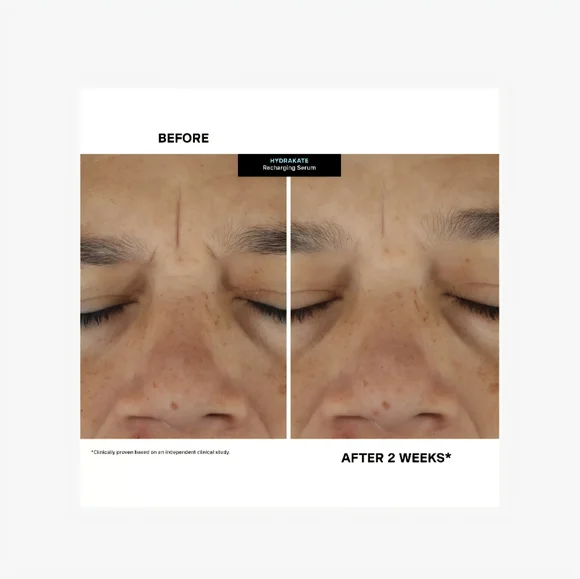 🆕 Kate Somerville Hydra Kate Serum hyaluronic acid 1 fl.oz. NIB - Picture 3 of 4